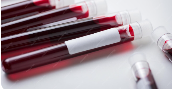 Determinación de grupo sanguíneo ABO y factor RH